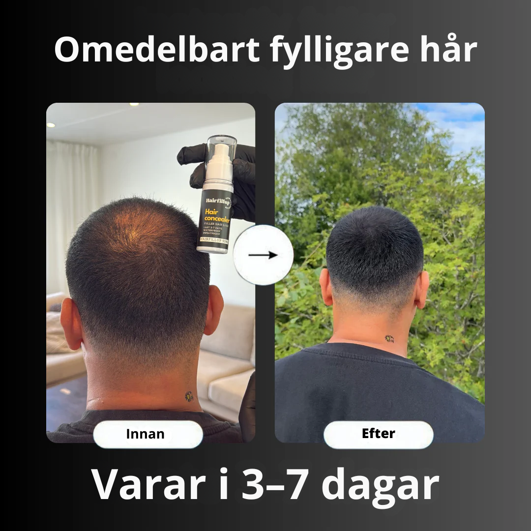 BoostHair- Få tillbaka ditt hår